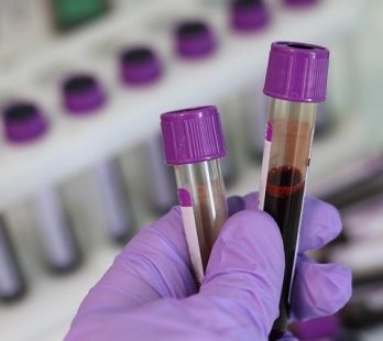 dasa coronavirus exame a domicílio