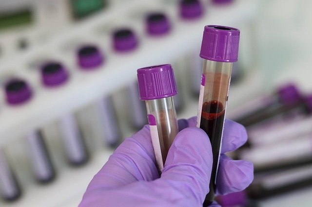 dasa coronavirus exame a domicílio